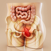 Piles<br>(बवासीर)